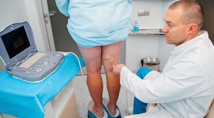 Diagnose von Krampfadern