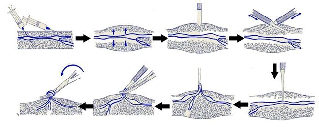 Varadi -Betrieb